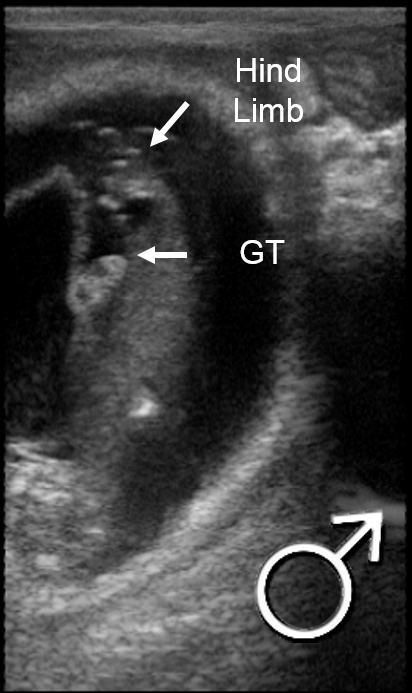 Ultrasound image 