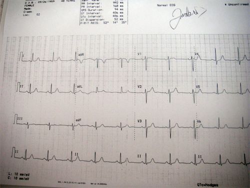 A copy of the results from my EKG  test.