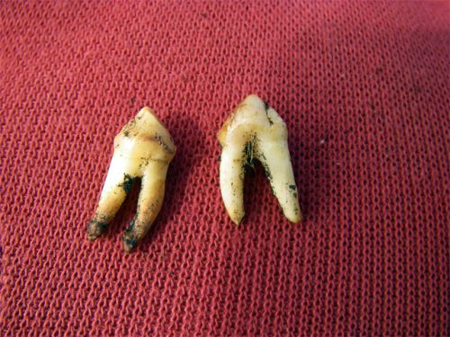 Two Small Fox Teeth Found in the Burial Area