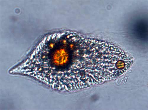 Here it is the heterotrophic dinoflagellate.