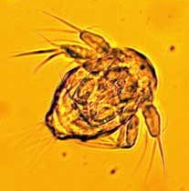 micro-zooplankton