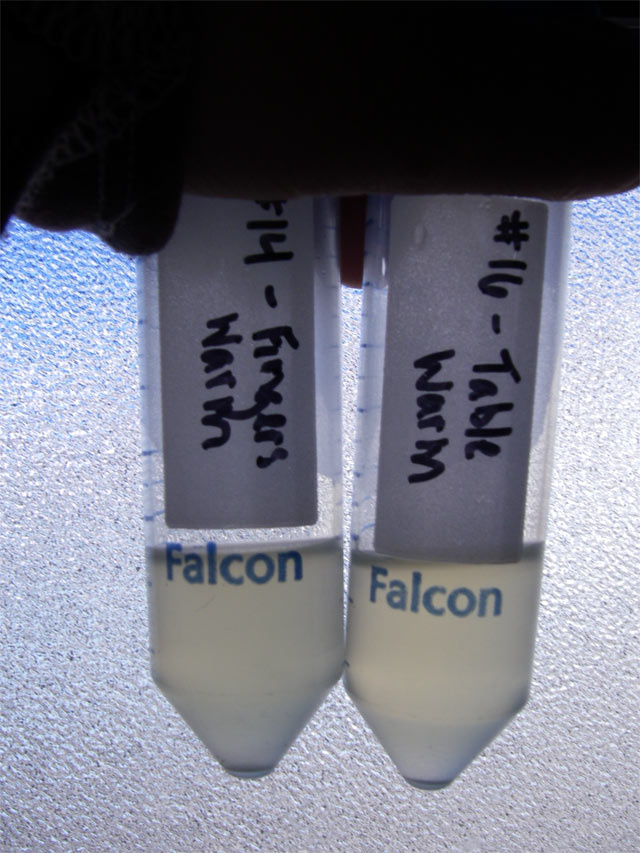 Which Tubes Grew Microorganisms On Day 2? 