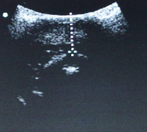 Ultrasound of baby Weddell seal blubber