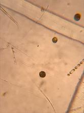 Alexadrium from the Chukchi Sea under a microscope.