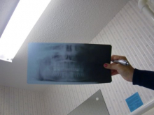 Pano x-ray