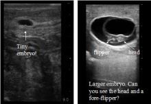 Wedell Seal Embryos