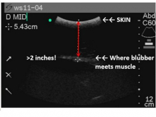 Reading an ultrasound