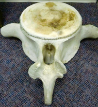 Whale vertebra