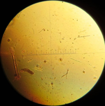 Diatoms