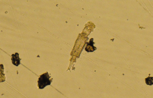 Bdelloid Rotifer