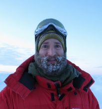 Frozen Beard