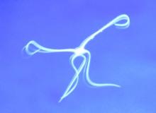 Brittle star