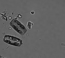 Diatom, Thalassiosira 