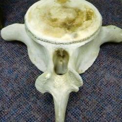 Whale vertebra