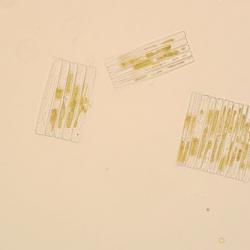 Diatoms